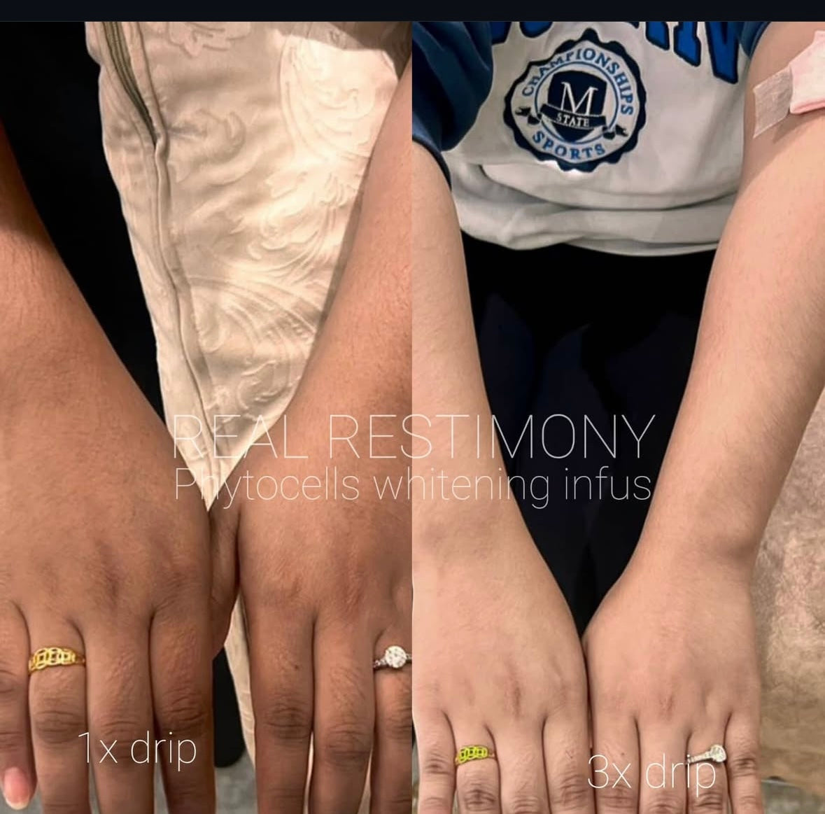 🔬Phyto Cells DNA Ultimate Whitening Injection - Rewrite your DNA, rewrite your beauty. 🔬