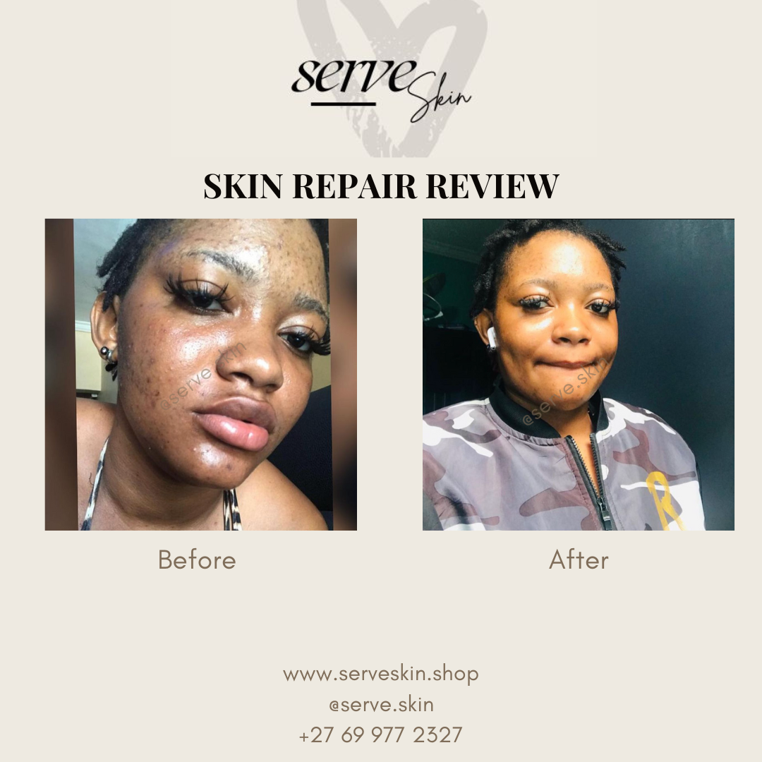 Skin Luminescence Caviar Oil with SPF