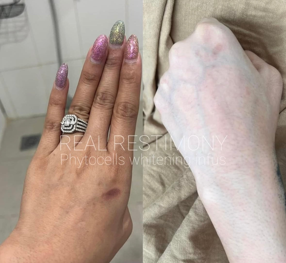 🔬Phyto Cells DNA Ultimate Whitening Injection - Rewrite your DNA, rewrite your beauty. 🔬