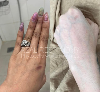 🔬Phyto Cells DNA Ultimate Whitening Injection - Rewrite your DNA, rewrite your beauty. 🔬